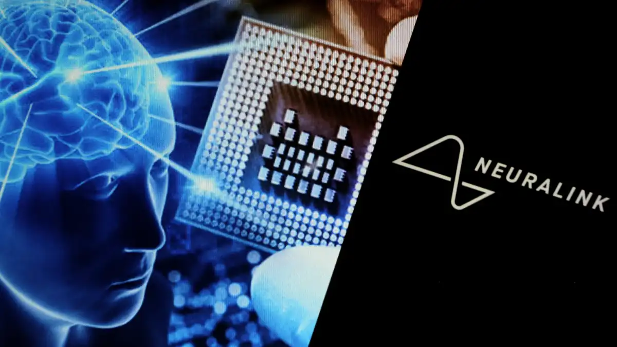 Neuralink Goes Mass Production, Surgery Now Fully Automated